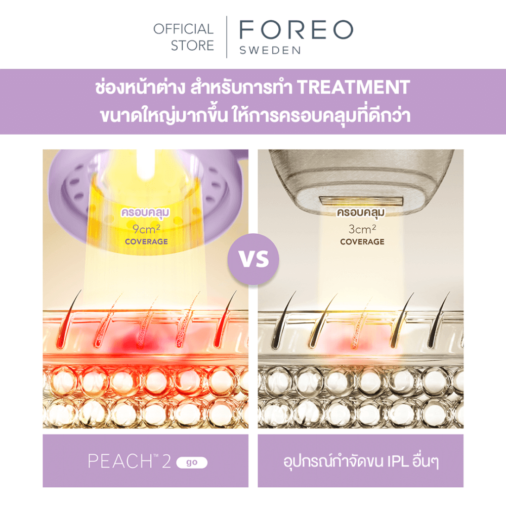 เครื่องกำจัดขน IPL FOREO PEACH 2 GO Peach